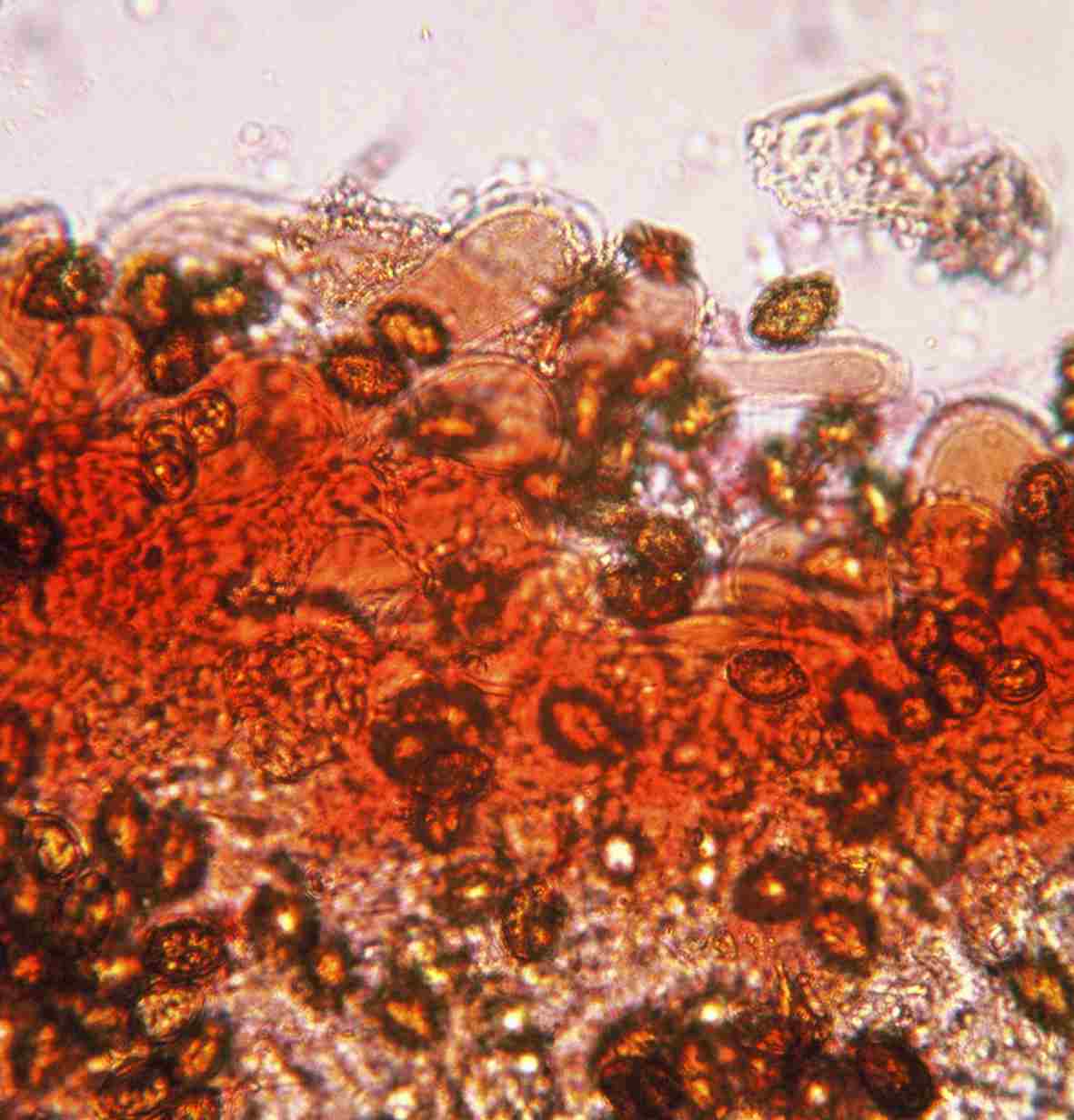 Myxacium - Defibulati